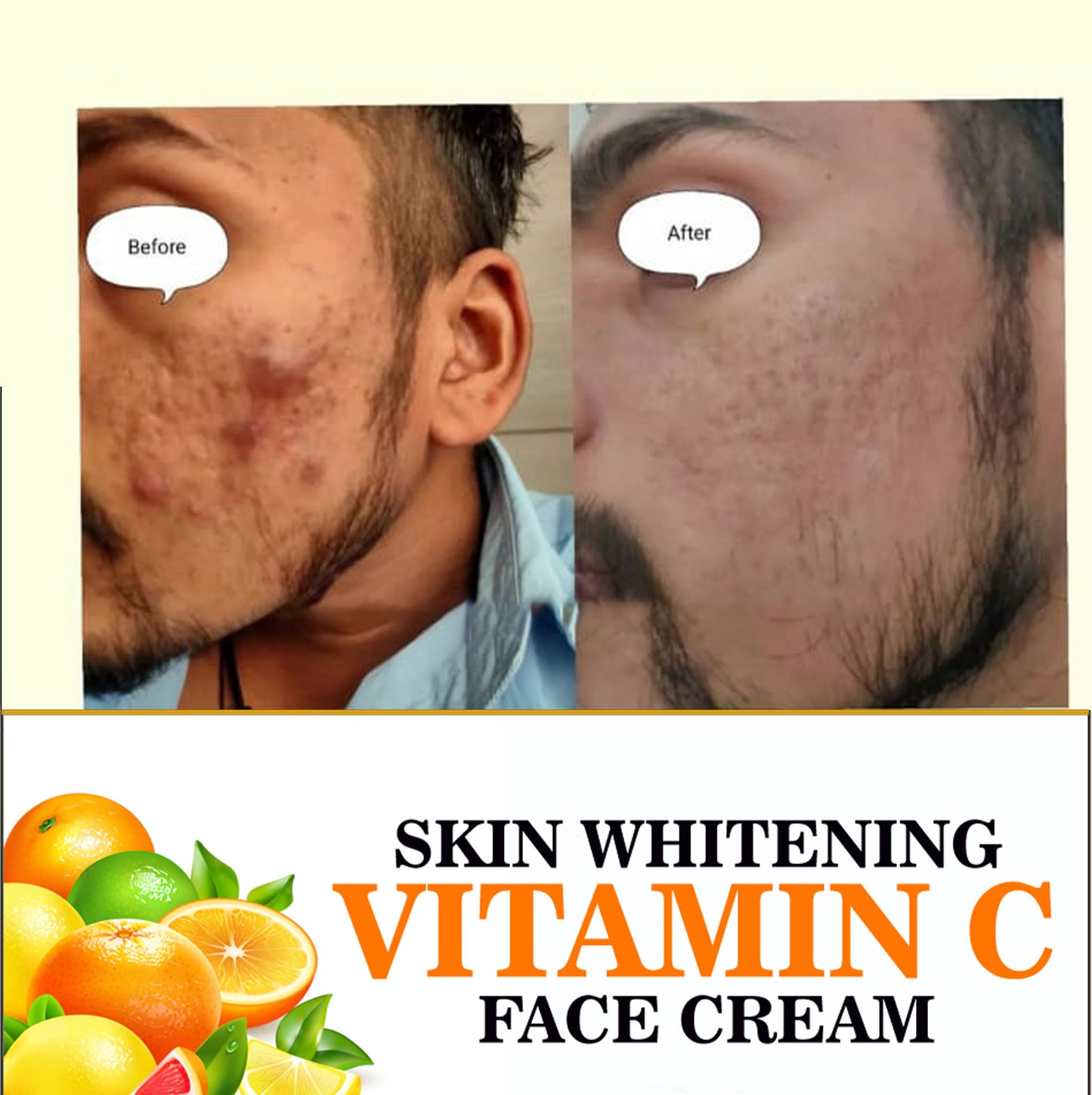 Evedics Vitamin C - Skin Whitening Cream