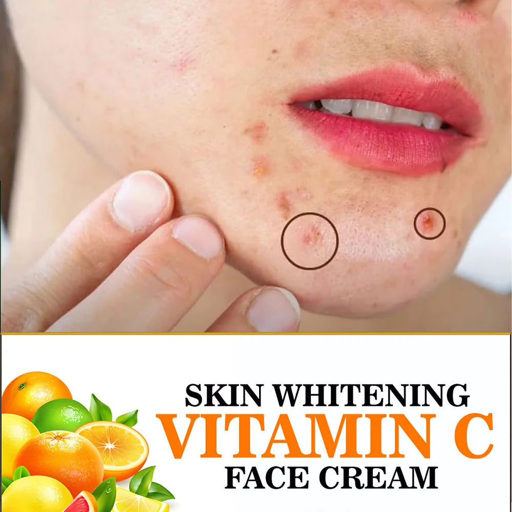 Evedics Vitamin C - Skin Whitening Cream