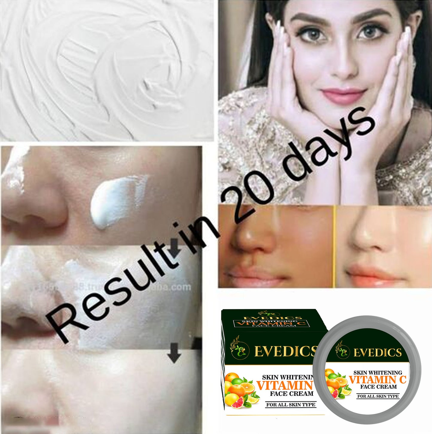 Skin Glowing Cream, Fast whitening cream Clear acne,dark spots,dark circles,hyperpigmentation,melasma-Evedics pro Glowing Cream